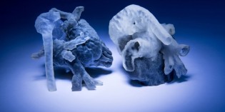 3D printing personalized heart models for surgical planning 3D printing personalized heart models for surgical planning