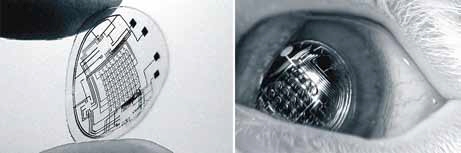 UW AR contact lenses