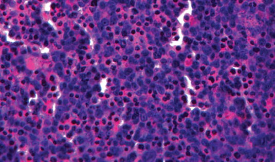 A cross-section of multi-cellular 3D bio-printed human liver tissue, stained with hematoxylin & eosin (H&E). (Source: Organovo)