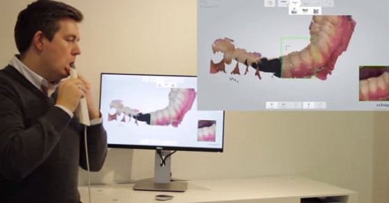 3D teeth scanning with real-time display (Source: 3Shape A/S)