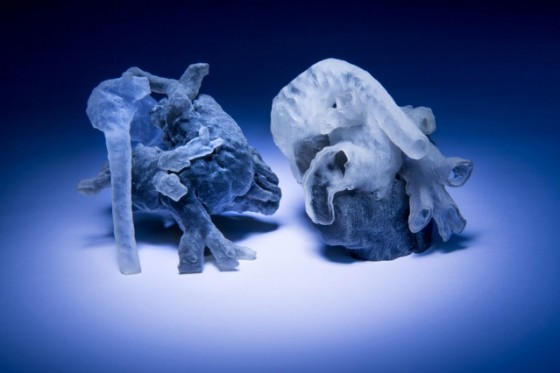 New system from MIT and Boston Children’s Hospital researchers converts MRI scans into 3D-printed heart models. (Source: MIT Press; Photo by Bryce Vickmark)